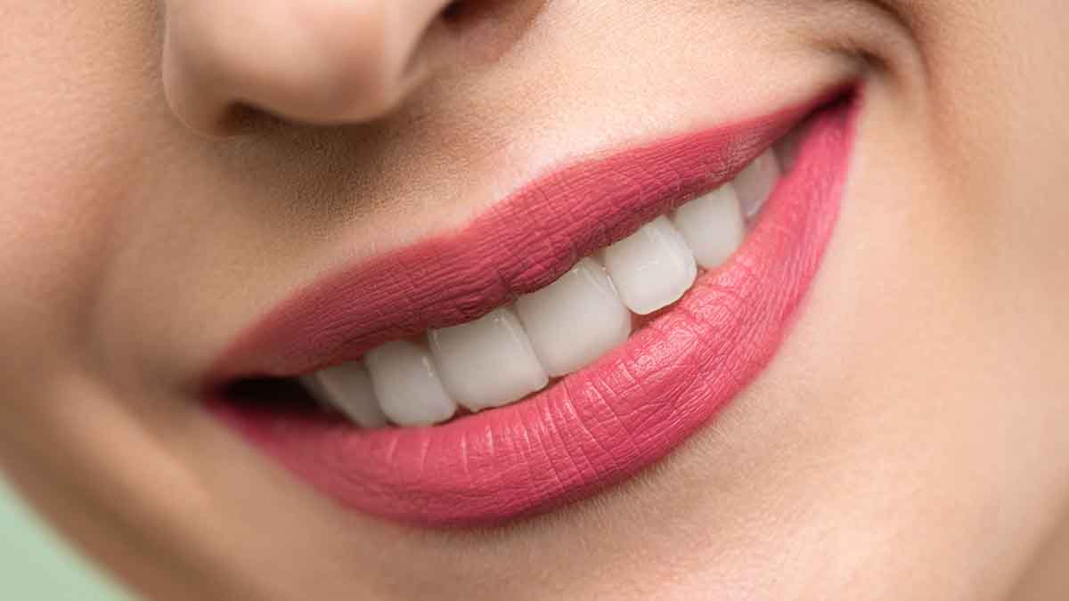 What is the process of teeth whitening